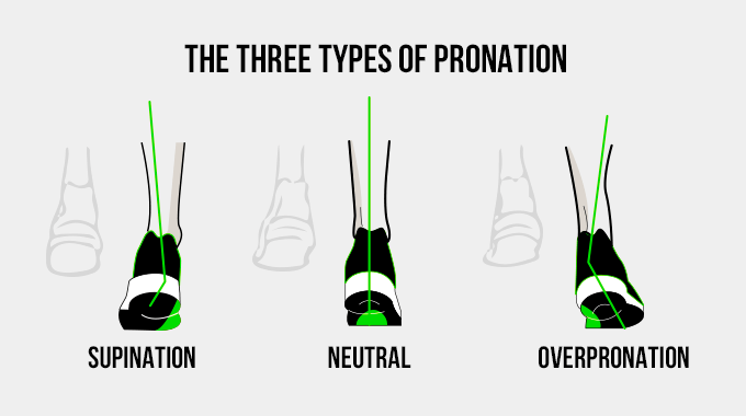 three types of pronation